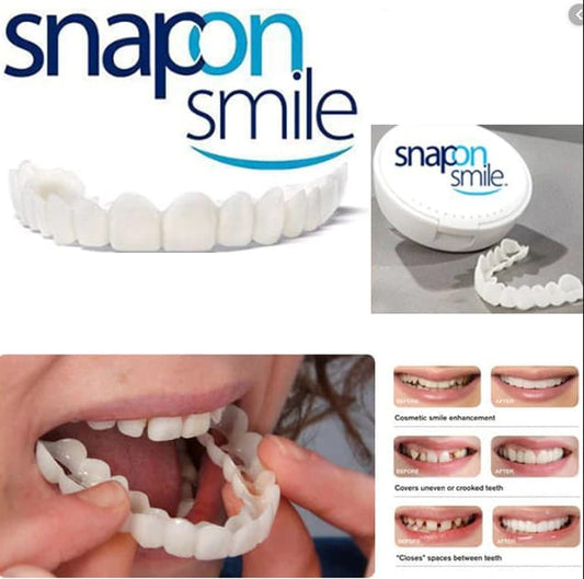 Snap-On Smile Silicone Imitation Braces – Safe & Eco-Friendly Teeth Decoration