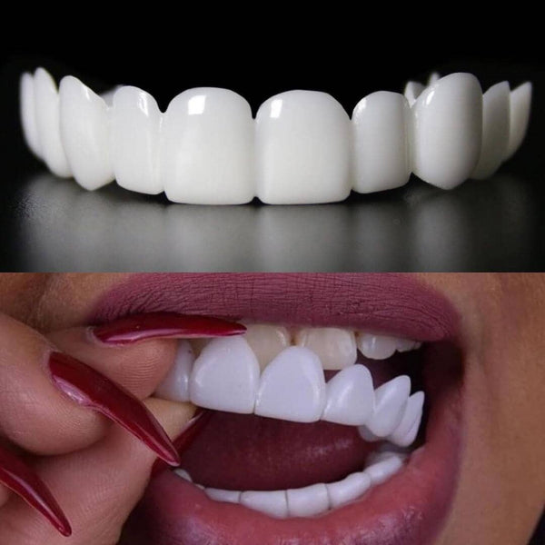 Snap-On Smile Silicone Imitation Braces – Safe & Eco-Friendly Teeth Decoration